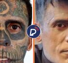 Imagens do antes e depois de Leandro. Na segunda foto, o homem se maquiou para esconder as poucas marcas que ainda est&atilde;o.