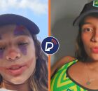 PARIS 2024: ap&oacute;s serem ESQUECIDOS, skatistas brasileiros voltam para Vila Ol&iacute;mpica de t&aacute;xi. Arte: Portal de Prefeitura