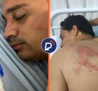 Ex-prefeito de Bom Jardim no hospital com ferimentos nas costas. 