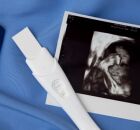 Imagem m&eacute;dica de crian&ccedil;a em gesta&ccedil;&atilde;o.