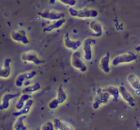 Morte de menina de um ano por ameba super-rara encontrada na &aacute;gua &eacute; investigada.