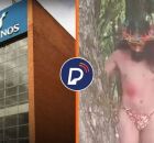 Universidade se posiciona. 