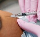 Inje&ccedil;&atilde;o de botox em testa de paciente.