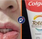 ANVISA retira proibi&ccedil;&atilde;o de venda do creme dental COLGATE, ap&oacute;s rea&ccedil;&otilde;es do uso devido subst&acirc;ncias
