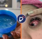 Pomada capilar causa irrita&ccedil;&atilde;o nos olhos