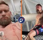 Ex-lutador de UFC nocauteia agressor ap&oacute;s ser esfaqueado no peito