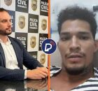 Morador baleado por delegado em Noronha ter&aacute; perna amputada.