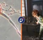Fungo Aspergillus e infectado de The Last of Us.