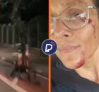 Ciclista fica com rosto machucado ap&oacute;s atropelar capivara e capotar em ciclovia