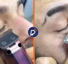 "C&iacute;lios na r&eacute;gua": nova tend&ecirc;ncia entre homens pode causar les&otilde;es nos olhos