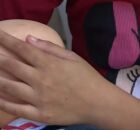 Menina de Goiana que foi baleada na cabe&ccedil;a.