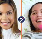 Cantora gospel Amanda Wanessa antes e depois do acidente.