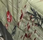 Marcas de sangue ap&oacute;s adolescente ser espancado pelo pai.