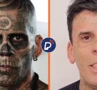 Antes e depois ap&oacute;s homem mais tatuado do Brasil remover marcas.