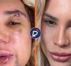 Influenciador antes e depois do procedimento.