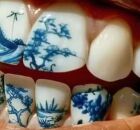 Tatuagem nos dentes.