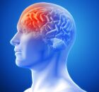 Meningite Meningoc&oacute;cica no Brasil