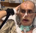 Piloto da Core baleado na cabe&ccedil;a durante opera&ccedil;&atilde;o no Rio de Janeiro mostra avan&ccedil;os na recupera&ccedil;&atilde;o.