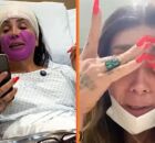 Rosto da influenciadora Maya Massafera infecciona ap&oacute;s cirurgia: "N&atilde;o consigo parar de chorar"