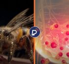 Veneno de abelha elimina c&eacute;lulas agressivas de c&acirc;ncer