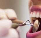 Maconha faz mal para os dentes. 