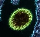 V&iacute;rus isolado Nipah observado em laborat&oacute;rio. 