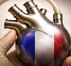 Cora&ccedil;&atilde;o artificial 