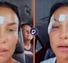 Ivete Sangalo recebe alta hospitalar e revela diagn&oacute;stico de s&iacute;ndrome vasovagal