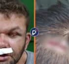 Dupla formada por homem cego e seu irm&atilde;o &eacute; agredida por vigilante durante briga por marmita