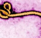 Paciente &eacute; internado com suspeita de ebola em S&atilde;o Paulo