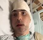 Comandante Felipe internado no hospital.