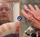 Segundo relatos do comunicador em suas redes sociais, uma mulher passeava com tr&ecirc;s cachorros, mas o de maior agressividade estava totalmente livre.