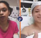 V&iacute;tima de ataque de tubar&atilde;o em Boa Viagem faz vaquinha para comprar pr&oacute;tese
