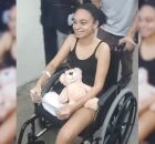 Estudante que teve perna arrancada por tubar&atilde;o em Boa Viagem recebe alta ap&oacute;s 40 dias