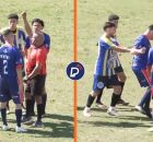 &Aacute;rbitro leva cabe&ccedil;ada ap&oacute;s expulsar jogador e vai precisar passar por cirurgia