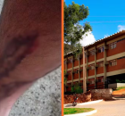 UFRPE &eacute; condenada a pagar R$ 10 mil a estudante atacado por c&atilde;es em universidade