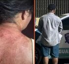 A v&iacute;tima foi atendida em um hospital e precisou levar pontos na cabe&ccedil;a.