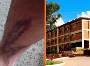 UFRPE &eacute; condenada a pagar R$ 10 mil a estudante atacado por c&atilde;es em universidade