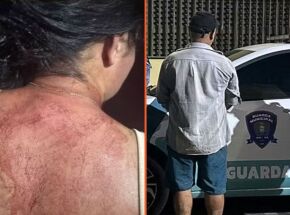 A v&iacute;tima foi atendida em um hospital e precisou levar pontos na cabe&ccedil;a.