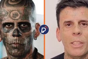 Antes e depois ap&oacute;s homem mais tatuado do Brasil remover marcas.