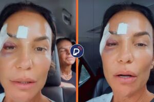 Ivete Sangalo recebe alta hospitalar e revela diagn&oacute;stico de s&iacute;ndrome vasovagal