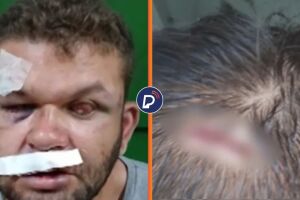 Dupla formada por homem cego e seu irm&atilde;o &eacute; agredida por vigilante durante briga por marmita