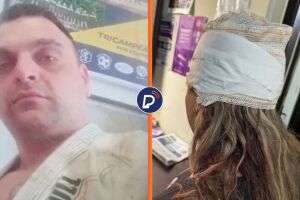 Lutador de jiu-j&iacute;tsu &eacute; preso ap&oacute;s atacar esposa e ferir filha de seis meses por ter sido acordado