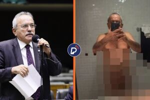 Ex-deputado federal publica imagem &iacute;ntima acidentalmente em rede social