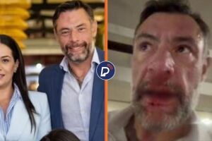 Deputado federal diz que foi agredido novamente pela esposa: "&Eacute; a &uacute;ltima, estou indo embora"