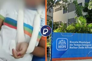 Uma estudante de 14 anos perdeu parte do dedo m&eacute;dio da m&atilde;o esquerda ap&oacute;s prend&ecirc;-lo na porta do banheiro da Escola Municipal de Tempo Integral (EMTI) Reitor Jo&atilde;o Alfredo. 