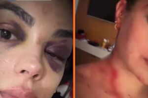 Ra&iacute;la Miranda denunciou o prefeito de Granito, George de Sidney, por supostas viol&ecirc;ncias f&iacute;sica, psicol&oacute;gica e patrimonial.