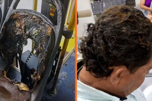 Motorista sofreu queimaduras durante inc&ecirc;ndio criminoso a &ocirc;nibus em Jardim Brasil, em Olinda.