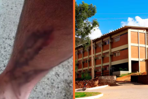 UFRPE &eacute; condenada a pagar R$ 10 mil a estudante atacado por c&atilde;es em universidade