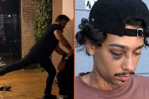 Imagens divulgadas pelo cantor o mostram recebendo socos e chutes.